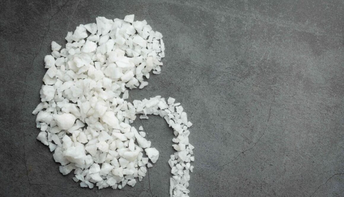 salt-shape-kidney-dark-floor (1)