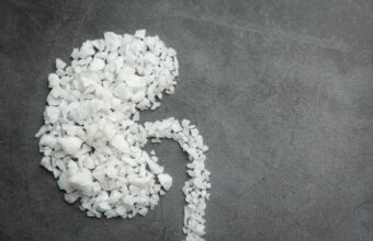 kidney and kidney dialysis